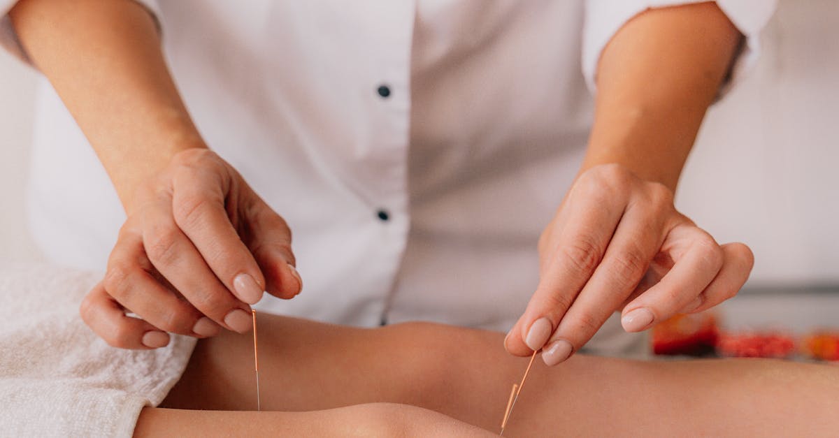 Benefits of Regular Acupuncture Sessions for Immune Function