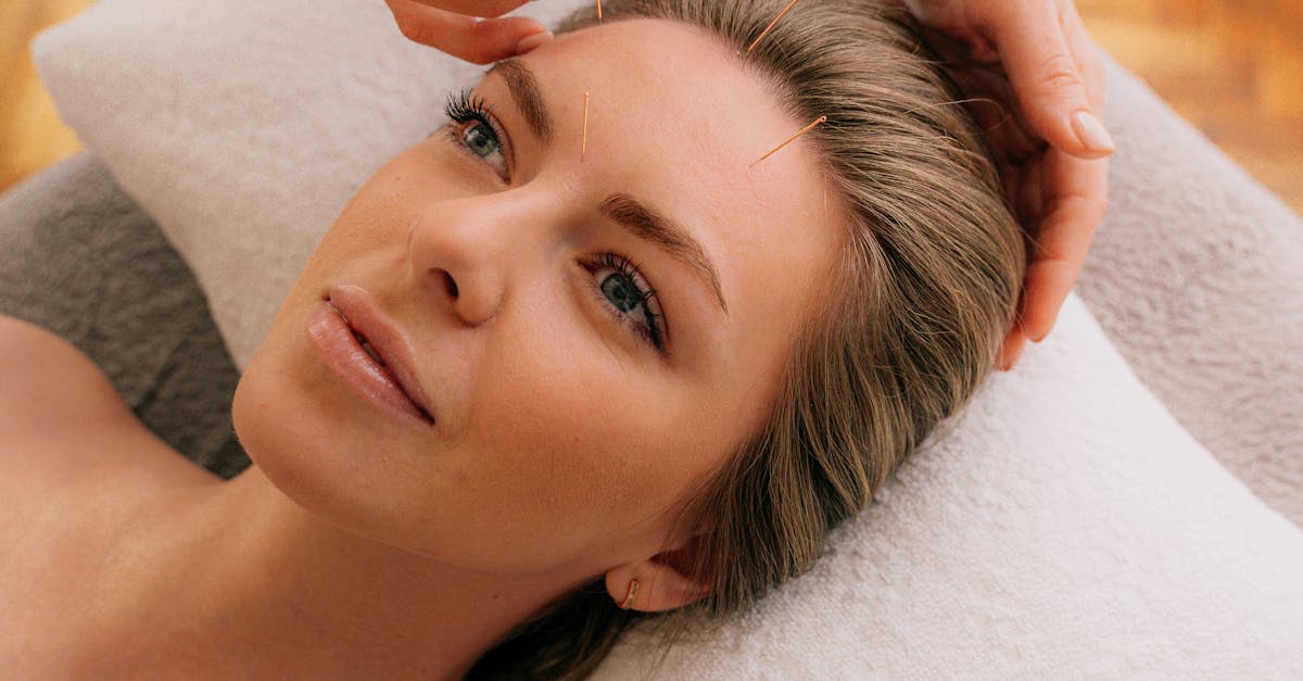 How Acupuncture Can Alleviate Migraines and Tension Headaches