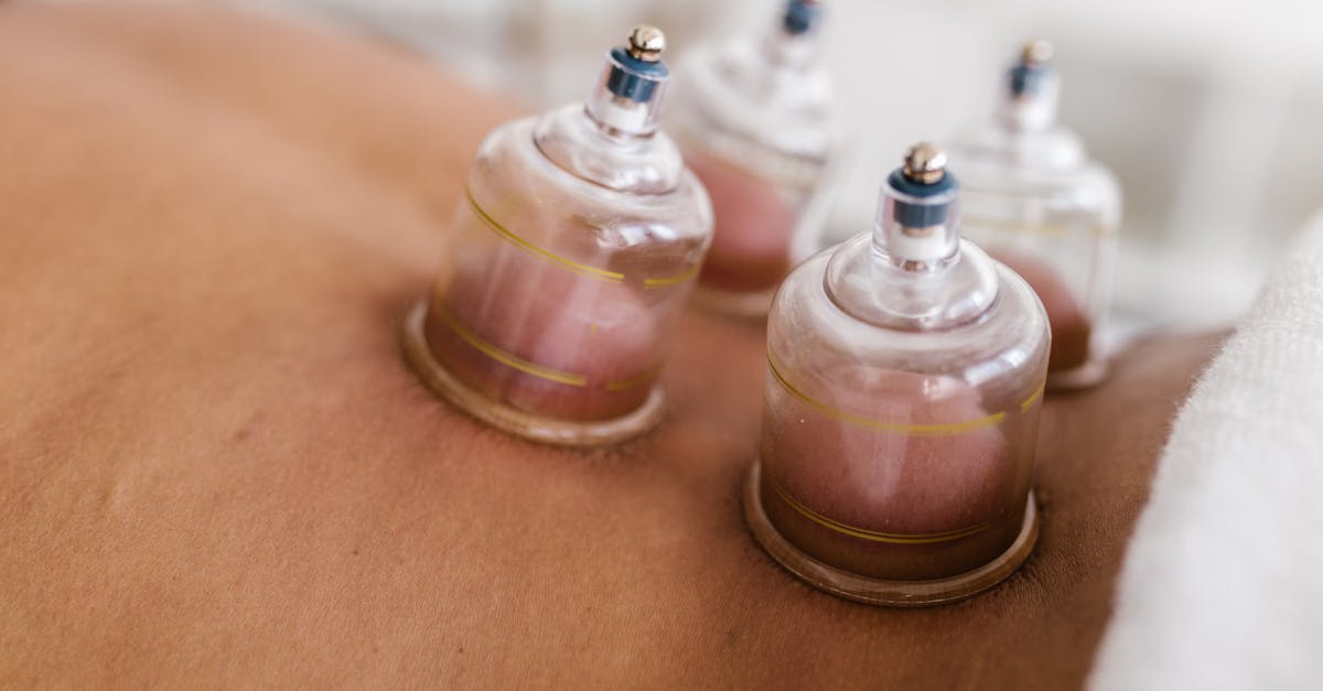 Integrating Cupping Therapy into Holistic Health Practices