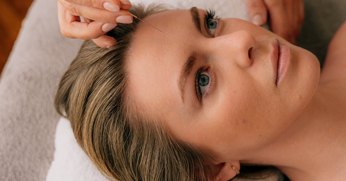 The Historical Significance of Traditional Chinese Acupuncture